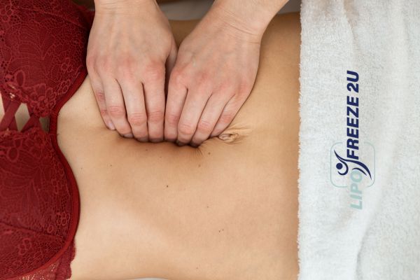 diastasis recti treatment Swansea