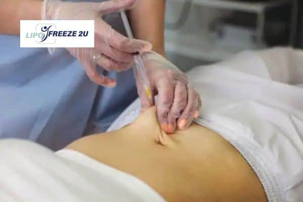 How Does Aqualyx Fat Dissolving Injection Work to Break Down Fat Swansea?