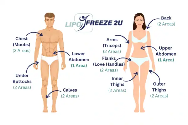 Areas you can have fat freezing treatment Swansea