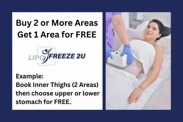 fat freezing prices Swansea